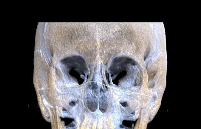 A L Aide J Ai Mal Au Nez Et Je Respire Tres Mal Estheticon Fr