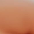Liposuccion alternative,non-invasive suppression de graisse et de cellulite - Cliché avant - RS Esthétique - Centre d’amincissement & remodelage de la silhouette anti-âge visage et corps sans chirurgie