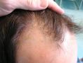 PANACEA HAIR CLINIC - Cliché avant - PANACEA HAIR CLINIC