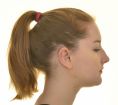 Otoplastie (Chirurgie esthétique des oreilles) - Harmonie de la forme de l