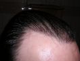 PANACEA HAIR CLINIC - Cliché avant - PANACEA HAIR CLINIC