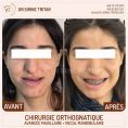 Chirurgie réparatrice du visage - Cliché avant - Dr Sirine Tritar