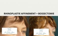 Dr Frédéric Barere - Cliché avant - Dr Frédéric Barere