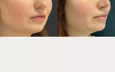 Dr Frédéric Barere - Cliché avant - Dr Frédéric Barere