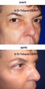 Dr Yohann Derhy - Cliché avant - Dr Yohann Derhy