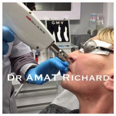 Dr Richard Amat Centre de Micro-greffe de cheveux FUE - Soin anti age sans eviction sociale, permet de relisser la peau, traiter les cicatrices d