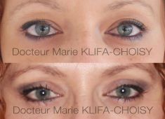 Dr Marie Klifa-Choisy - Cliché avant - Dr Marie Klifa-Choisy