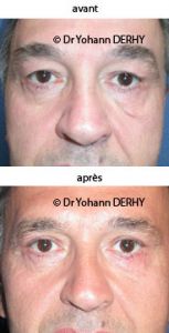 Dr Yohann Derhy - Cliché avant - Dr Yohann Derhy