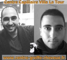 Centre Capillaire Villa La Tour - Cliché avant - Centre Capillaire Villa La Tour