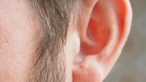 Earfold : pour les oreilles décollées