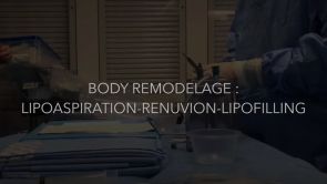 Body Remodelage : Lipoaspiration - Renuvion - Lipofilling