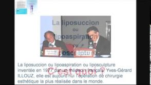 Liposuccion - Lipoaspiration - Liposculpture - Clinique esthétique IRAQI - Maroc