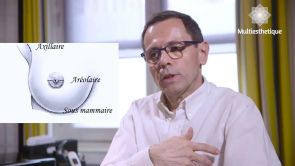 Augmentation par implant mammaire - Dr Laurent Oddou