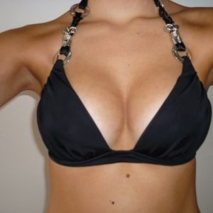 Le choix de la taille des implants - Les implants mammaires ...
