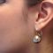 Rhinoplastie