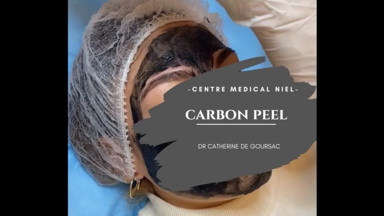 Carbon peel - Dr Catherine De Goursac