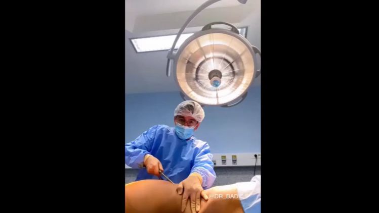 Lipossuccion - Dr Behzad Badie Modiri | Estheticon.fr